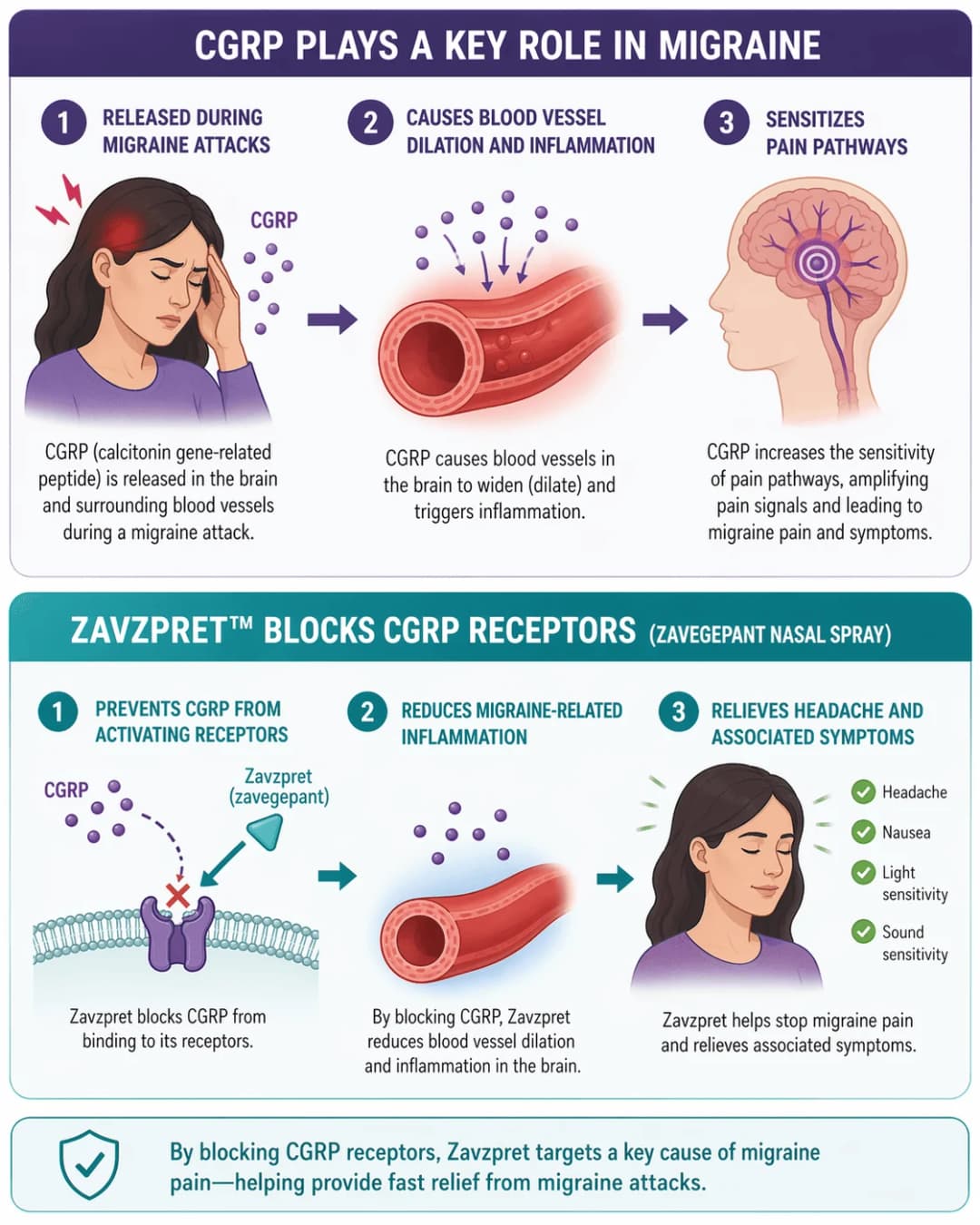 Infographic on how Zavzpret (zavegepant) nasal spray works for migraine: CGRP (calcitonin gene-related peptide) is released in the brain and surrounding blood vessels during a migraine attack, causing cranial blood vessel dilation and inflammation and sensitizing central pain pathways; zavegepant is a small-molecule CGRP receptor antagonist (gepant) delivered as an intranasal spray that prevents CGRP from binding to its receptors, reducing neurogenic inflammation and blood vessel dilation in the brain to relieve headache pain, nausea, light sensitivity (photophobia), and sound sensitivity (phonophobia) during an acute migraine attack