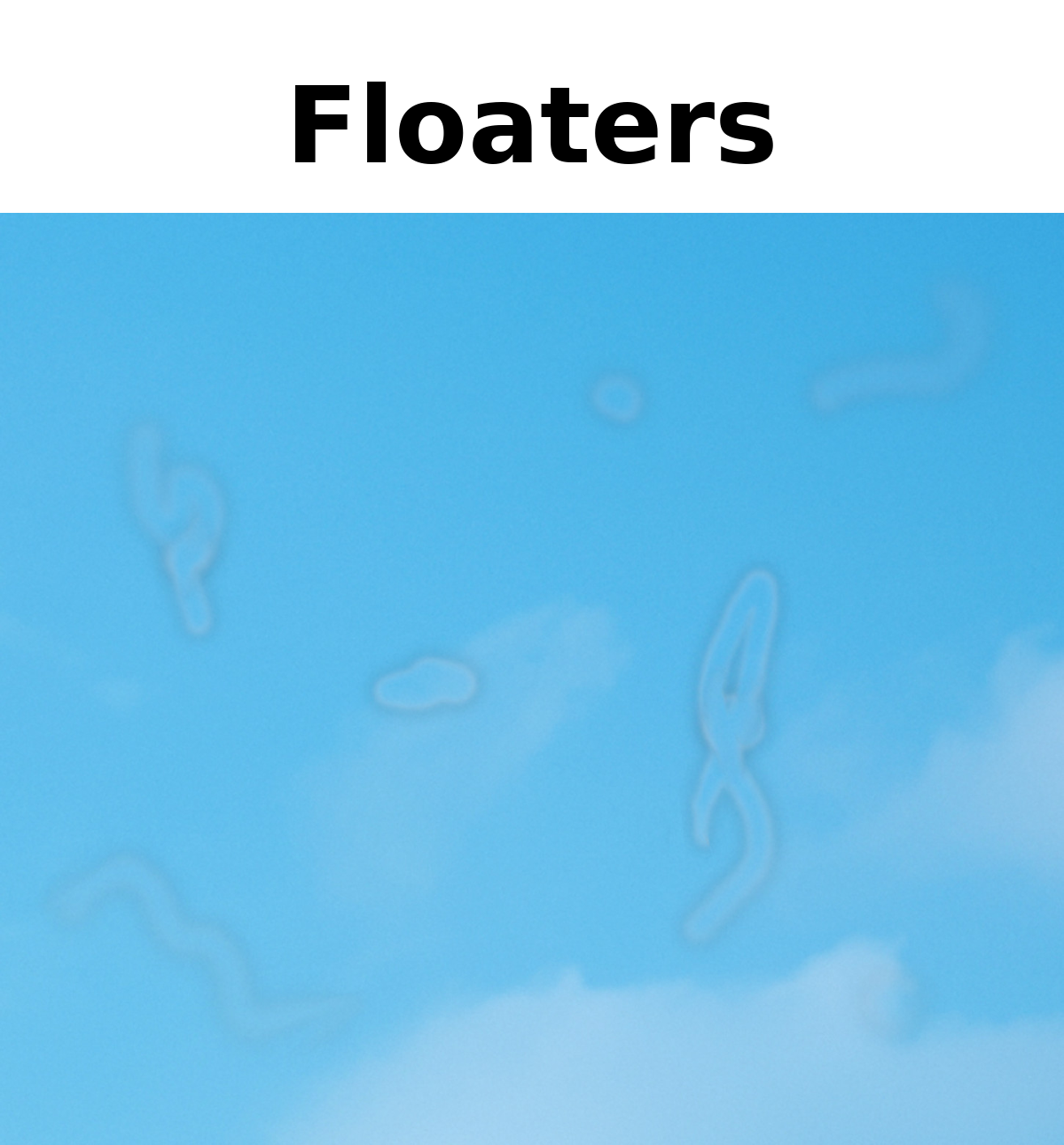 Simulation of eye floaters showing squiggly strands and spots drifting across a bright blue sky